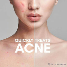 Load image into Gallery viewer, Primalderm™ High Frequency Therapy