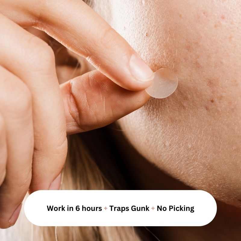 Primalderm Original Pimple Patch SUB