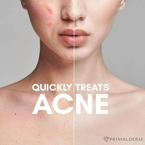 Primalderm High Frequency Therapy | Clear Acne and Prevent Future Breakouts