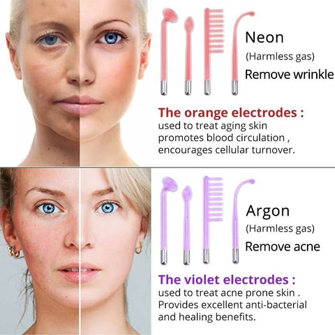 Primalderm High Frequency Therapy | Clear Acne and Prevent Future Breakouts