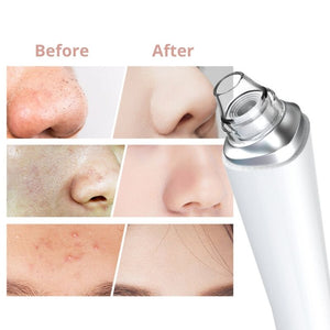 Primalderm™ Facial Pore Cleanser PRO