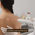 Primalderm High Frequency Therapy