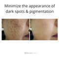Primalderm LED Face Therapy Mask