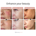 Primalderm LED Face Therapy Mask