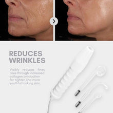 Load image into Gallery viewer, Primalderm™ High Frequency Therapy